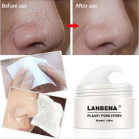 Blackhead Remover Nose Mud Mask Pore Strip Peeling Acne Treatment - sparklingselections