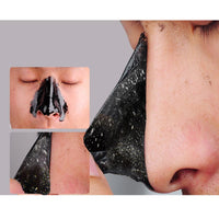 Blackhead Remover Acne Treatment Mask Skin Care 100g - sparklingselections
